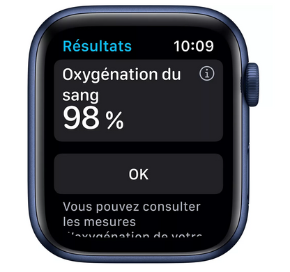 Apple Watch SE